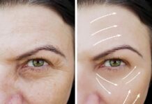 How Can Fillers Assist Facial Contouring? Fillers Assist