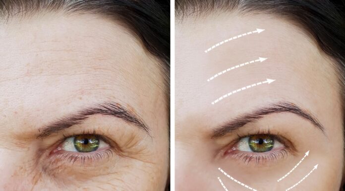 How Can Fillers Assist Facial Contouring? Fillers Assist